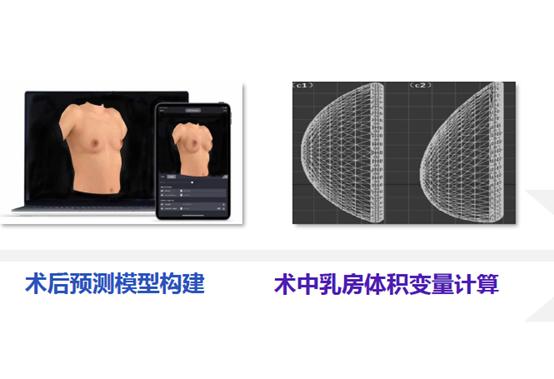 隆胸术前3D建模